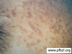 ���˱�ƽ���ʲôʳ��ȽϺ�